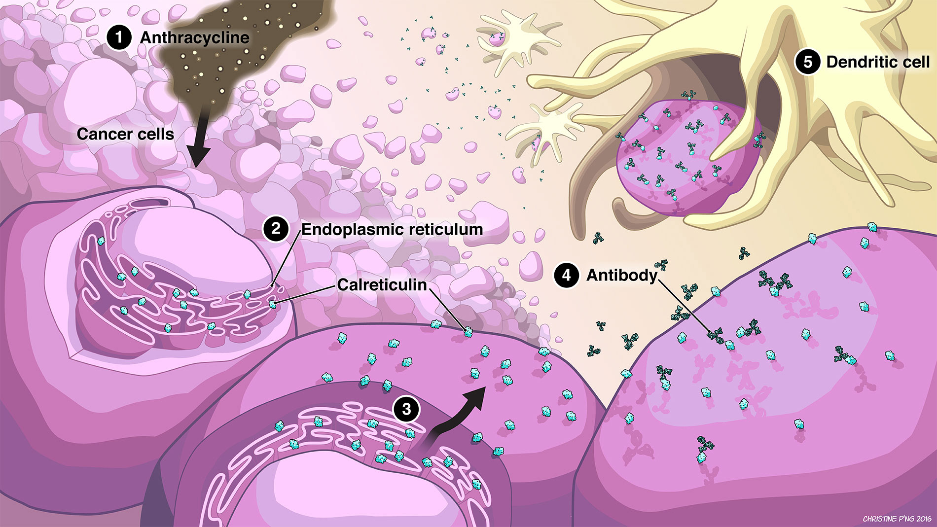 Cell-shaded depiction of cancer cells being attacked by anthracycline